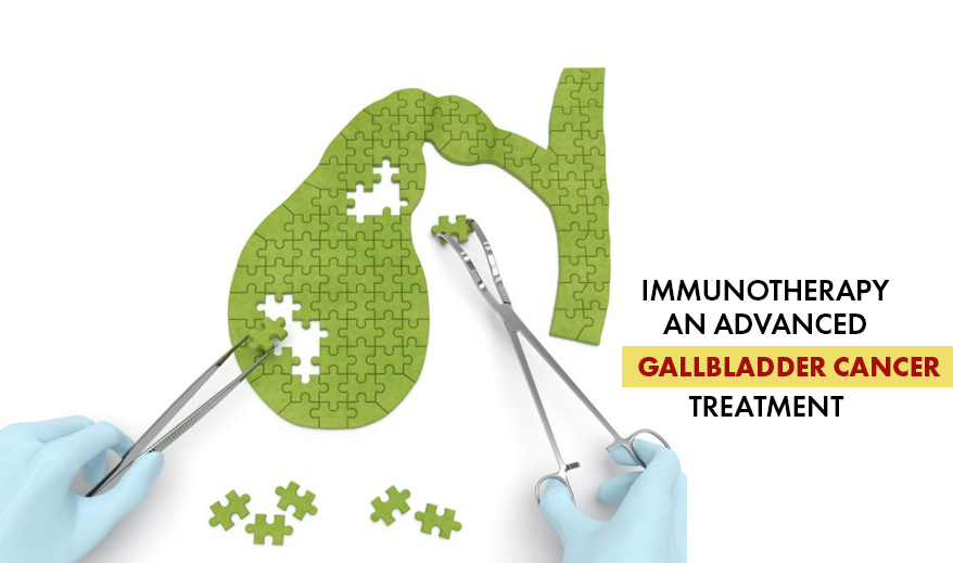 Immunotherapy: An Advanced Gallbladder Cancer Treatment 